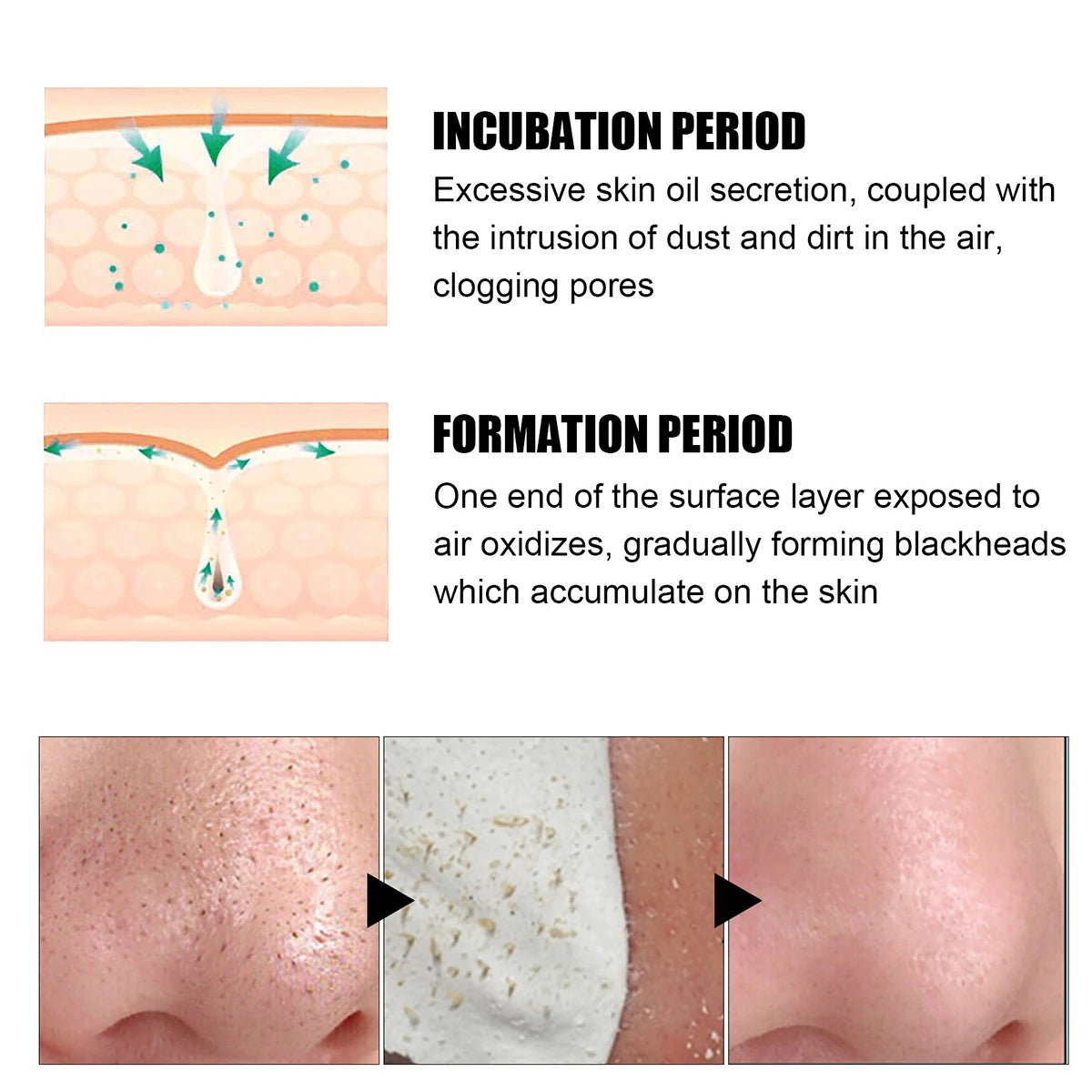 Deep Cleansing Blackhead Remover Patches