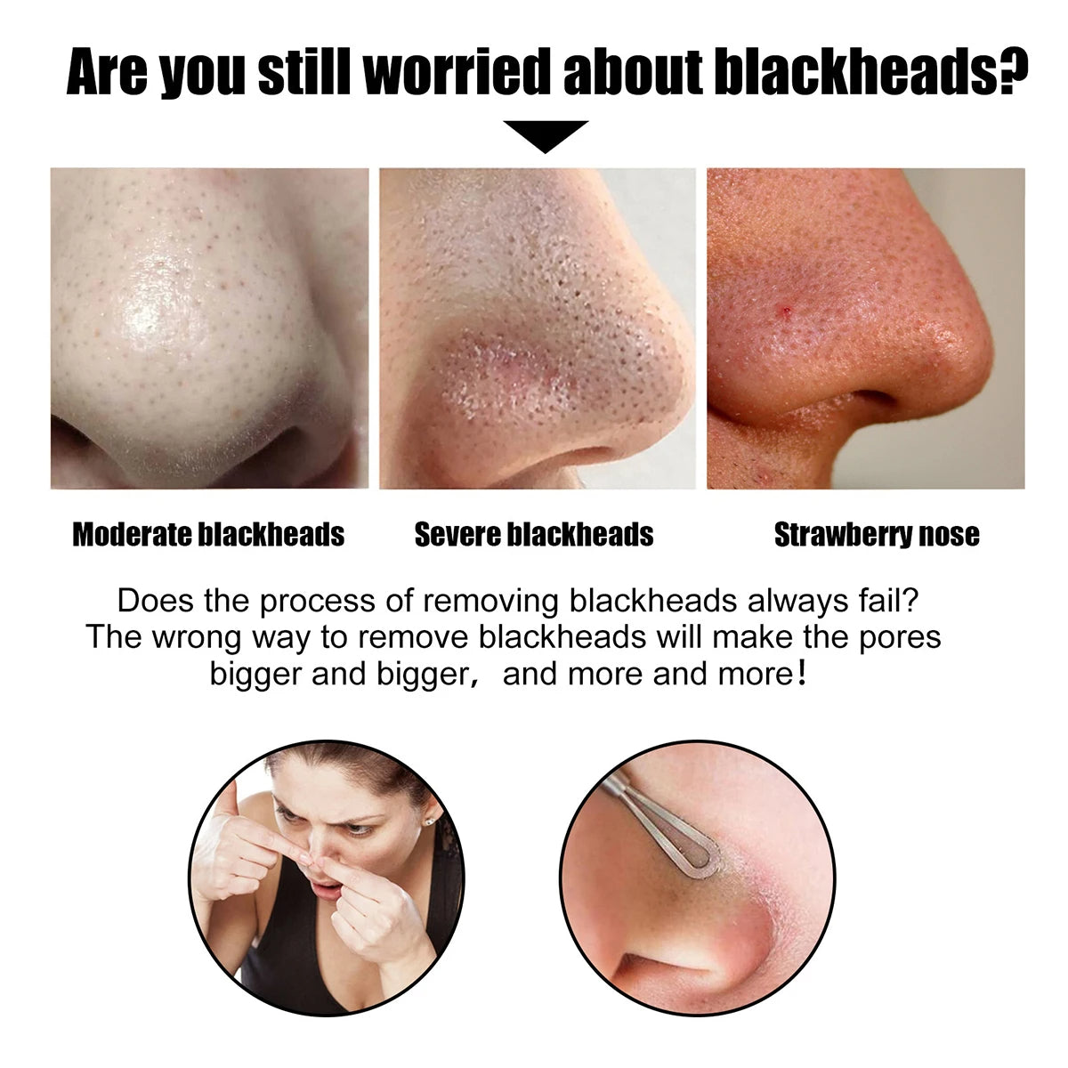 Deep Cleansing Blackhead Remover Patches